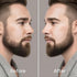 EELHOE Beard Filler Pen Kit for Men